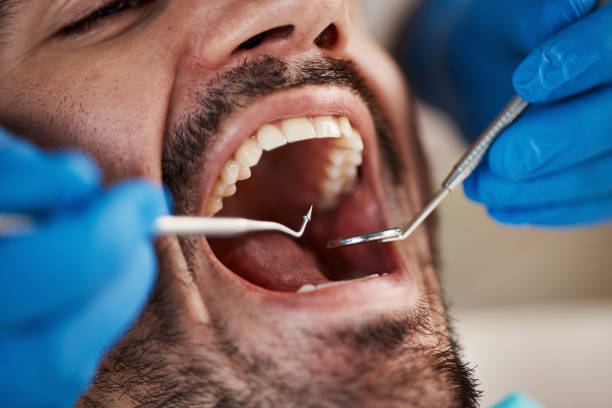 Urgent Tooth Repair in TN