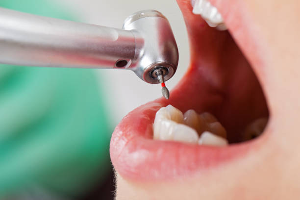 Best Tooth Infection Emergency Dentist  in Biltmore, TN